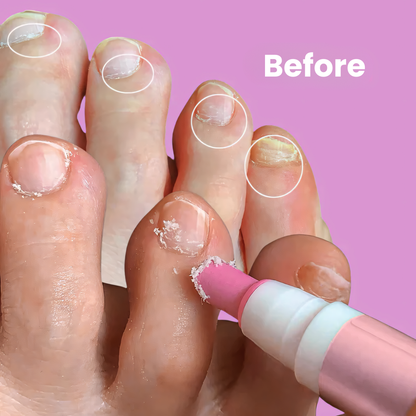 Cuticle Care Pen