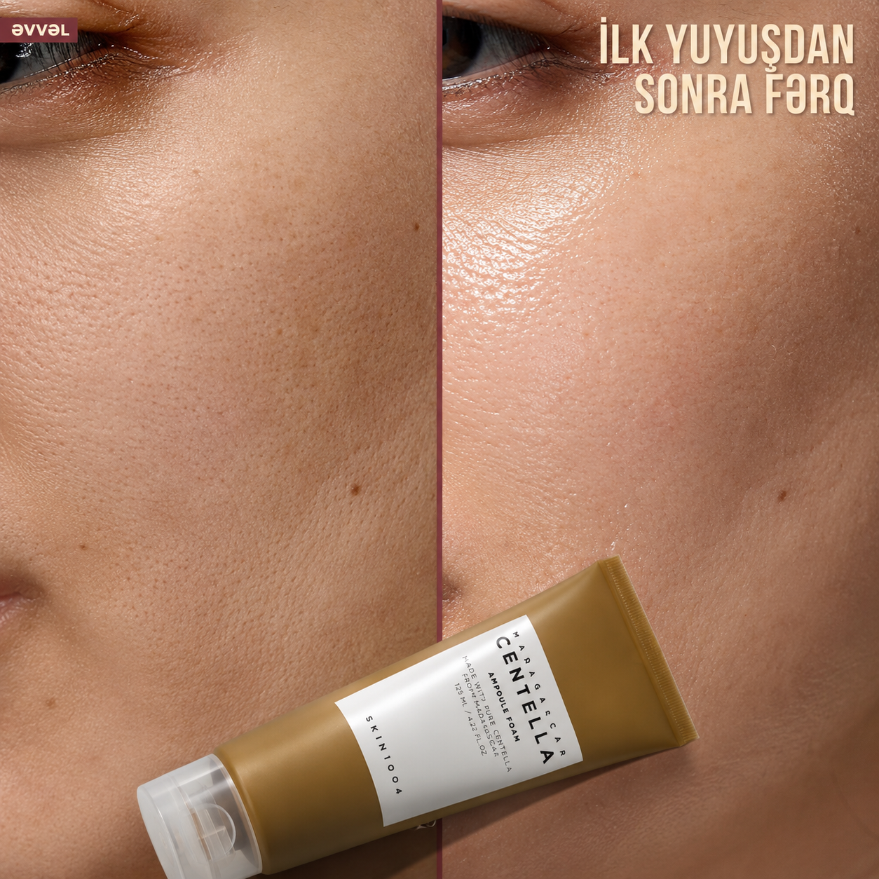 SKIN1004 Ampul Köpük